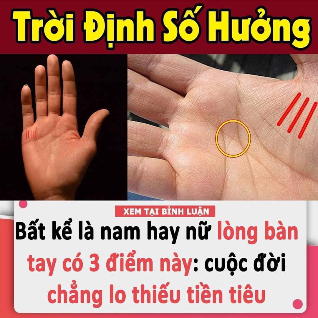 Bất Kể Là Nam Hay Nữ Lòng Bàn Tay Có 3 Điểm Khác Người Này: Cuộc Đời Chẳng Lo Thiếu Tiền Tiêu